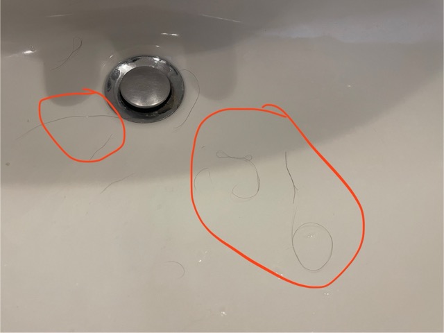 Beweisfoto: Kein Haarausfall mehr