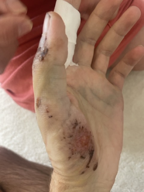 Verband wechseln